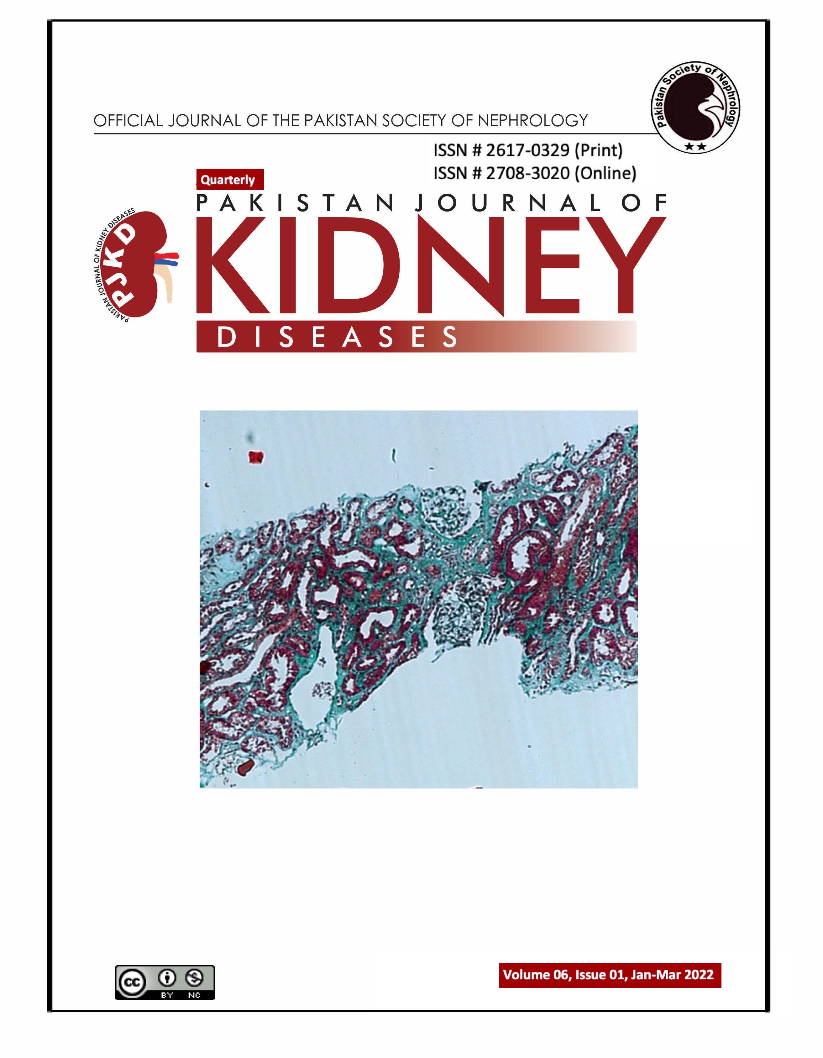 					View Vol. 6 No. 1 (2022): Pakistan Journal of Kidney Diseases
				