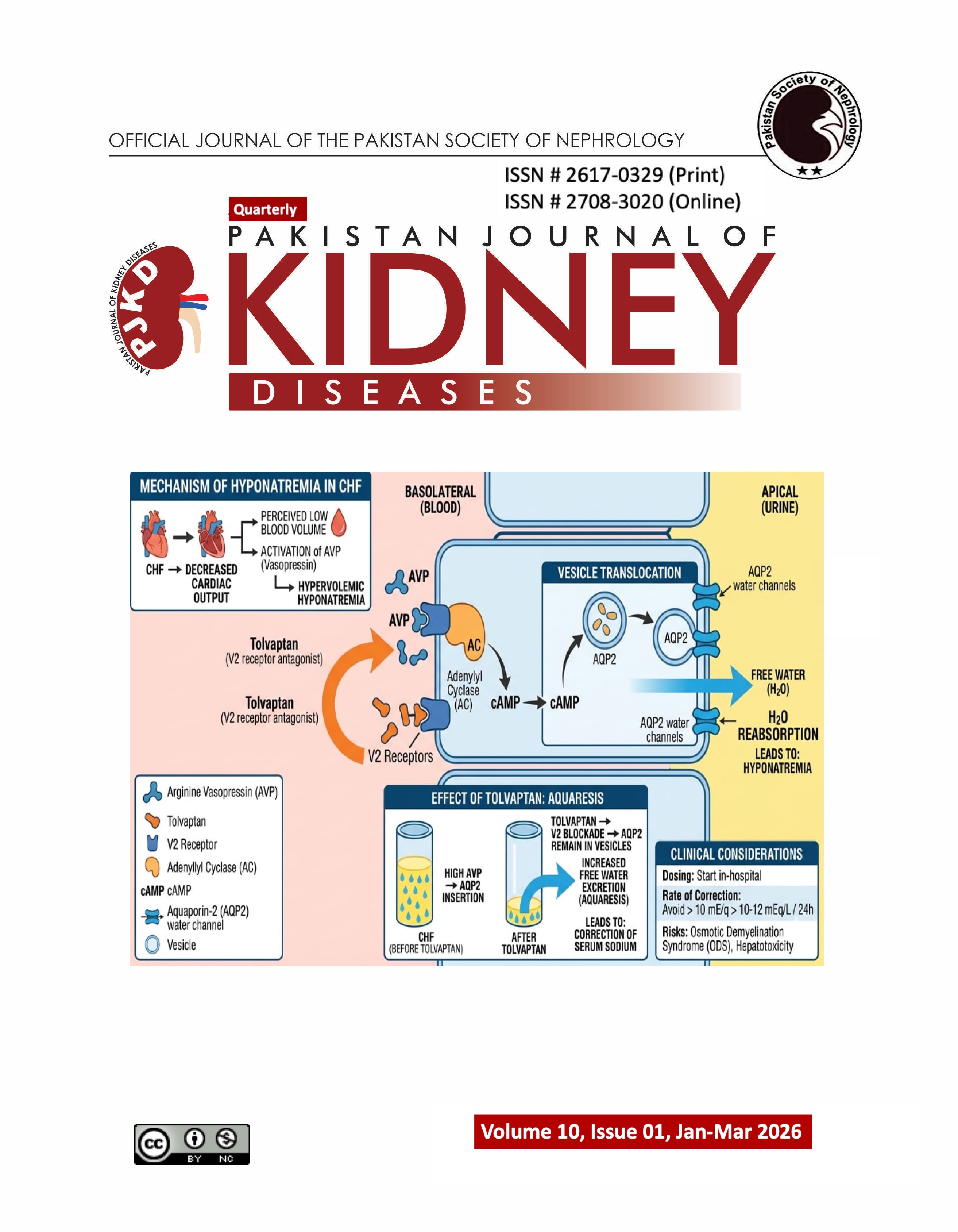 					View Vol. 10 No. 1 (2026): Pakistan Journal of Kidney Diseases
				