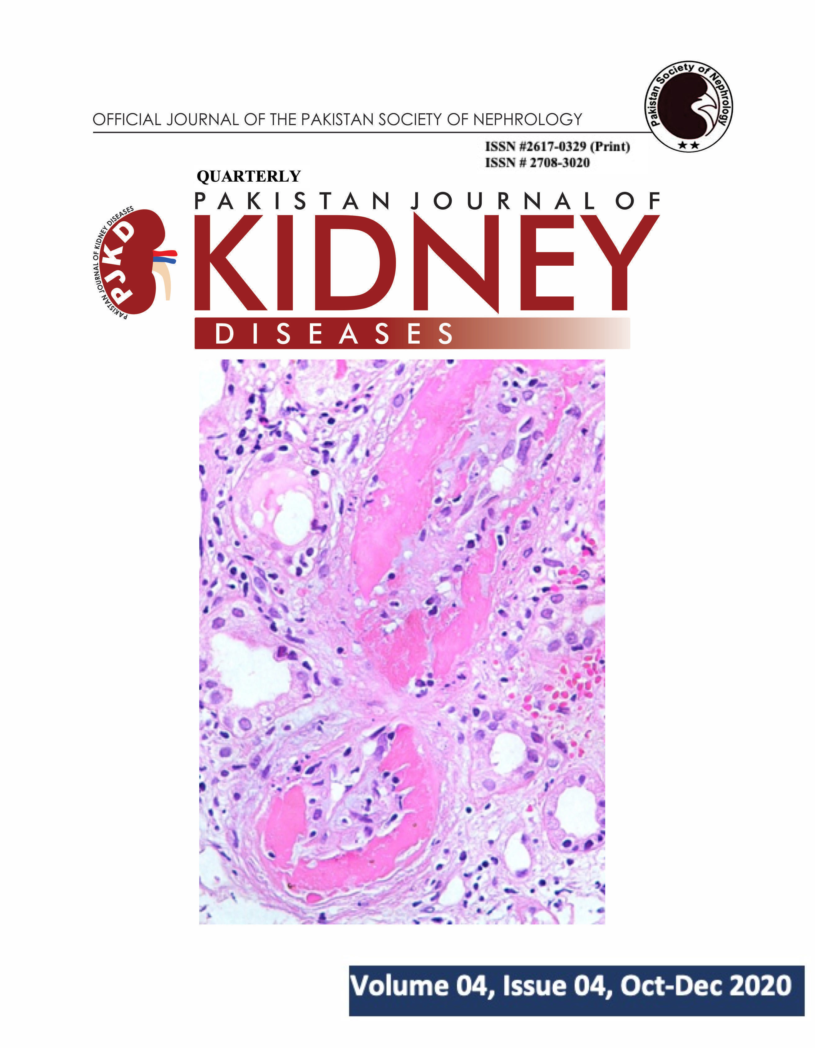 Nail‑Patella syndrome with early onset end‑stage renal disease in a child  with a novel heterozygous missense mutation in the LMX1B homeodomain: A  case report